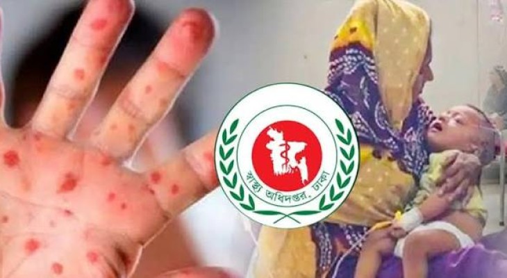 একদিনে হাম সন্দেহে চারজনের মৃত্যু